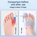 Tawazun™（Hallux valgus corrector）