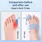 Tawazun™（Hallux valgus corrector）