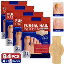 لاصقات تجديد الأظافر المتطورة NAILVORA™