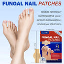 لاصقات تجديد الأظافر المتطورة NAILVORA™