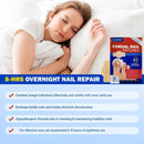 لاصقات تجديد الأظافر المتطورة NAILVORA™