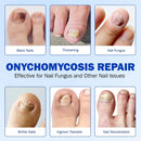 لاصقات تجديد الأظافر المتطورة NAILVORA™